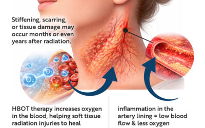 Radiation Wound Not Healing? 4 Things to Know About Delayed Radiation Tissue Injury